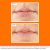 Előtte és utána fotó az ajkakról az O’Keeffe’s Lip Repair ajakbalzsam SPF 15 használata előtt és után