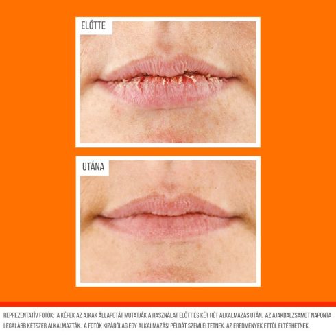 Előtte és utána fotó az ajkakról az O’Keeffe’s Lip Repair ajakbalzsam Cherry használata előtt és után